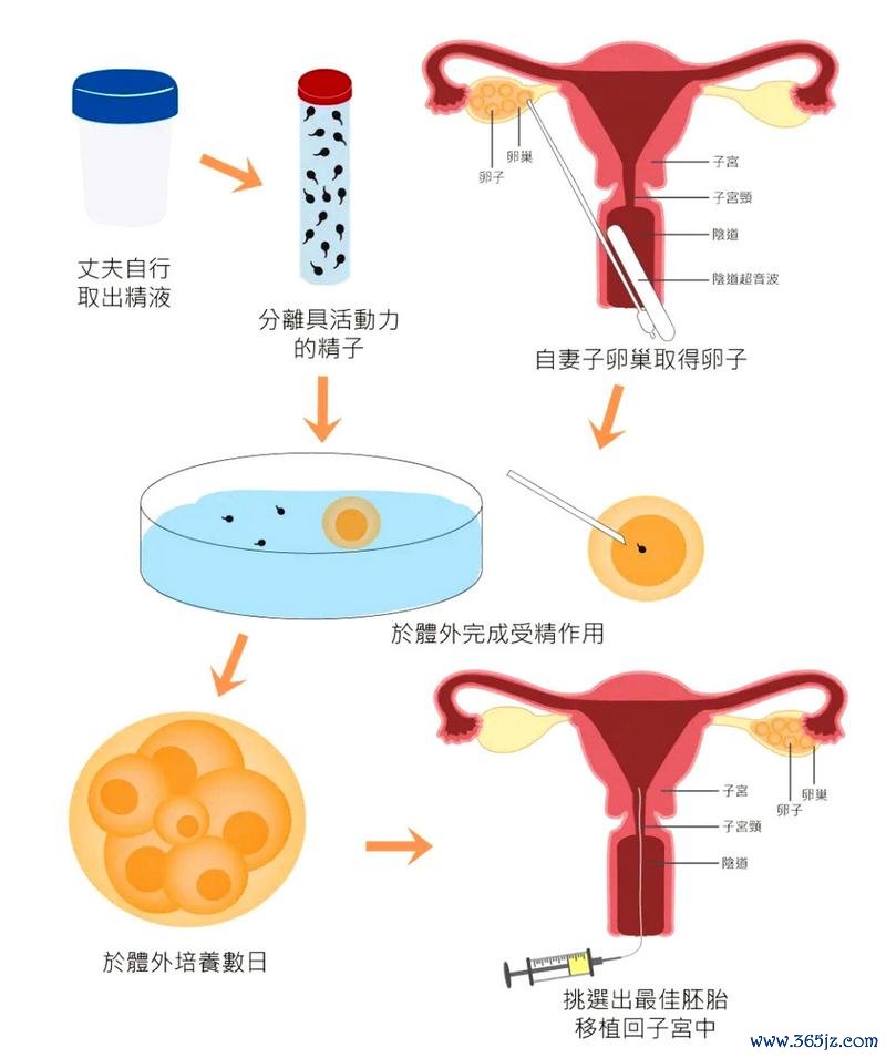 不孕不育专业治疗试管婴儿技术优势